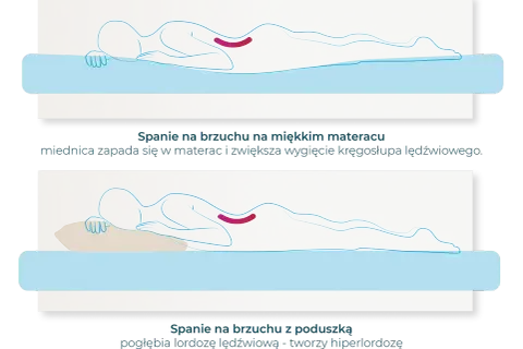 Ilustracja pokazuje, jak nieprawidłowa pozycja spania na brzuchu pogłębia lordozę lędźwiową. Prawidłowa pozycja spania jest kluczowa dla zdrowia kręgosłupa.