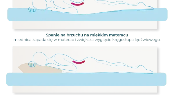 Ilustracja pokazuje, jak nieprawidłowa pozycja spania na brzuchu pogłębia lordozę lędźwiową. Prawidłowa pozycja spania jest kluczowa dla zdrowia kręgosłupa.
