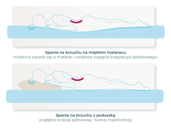 Ilustracja pokazuje, jak nieprawidłowa pozycja spania na brzuchu pogłębia lordozę lędźwiową. Prawidłowa pozycja spania jest kluczowa dla zdrowia kręgosłupa.